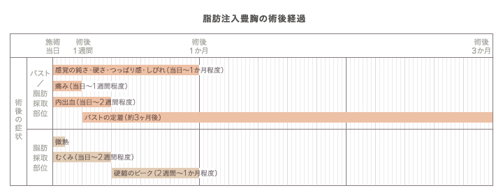 脂肪注入豊胸のダウンタイムスケジュール