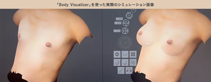 シリコンバッグ豊胸の完成サイズをイメージできる3Dシミュレーションソフト「Body Visualizer」