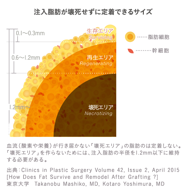 注入脂肪が壊死せず定着できるサイズ