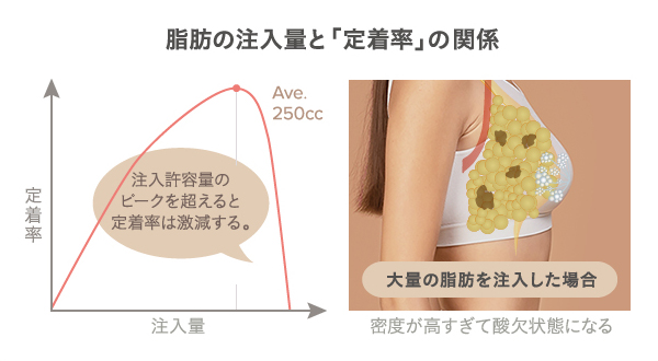 脂肪注入豊胸の注入量と定着率の関係を示すイメージグラフと大量注入で定着率が低下する原因